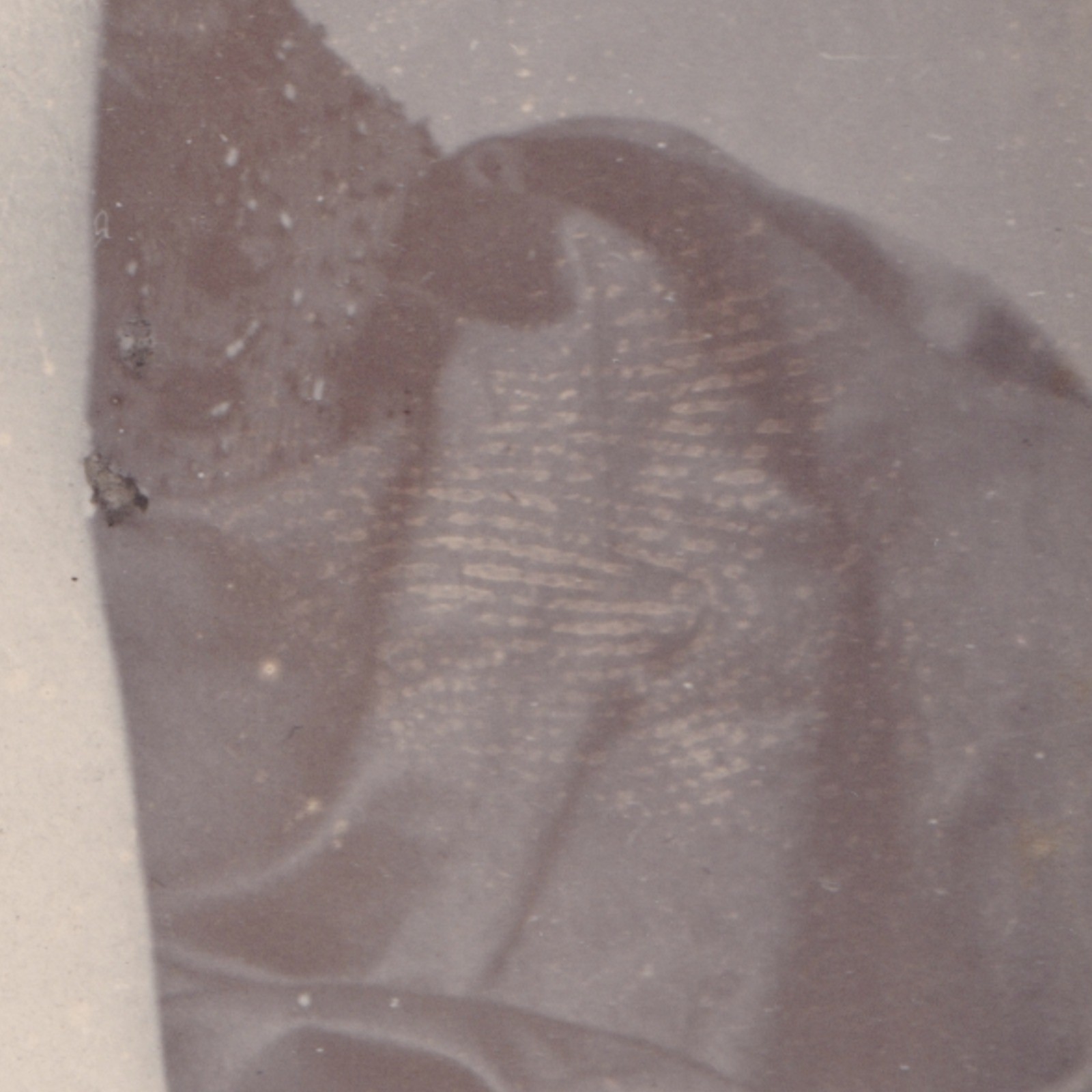 Cabinet Card: Cabinet Card: E. Everett, Nr Dunstable. Woman in Thoughtful Pose.: catalogue image 9