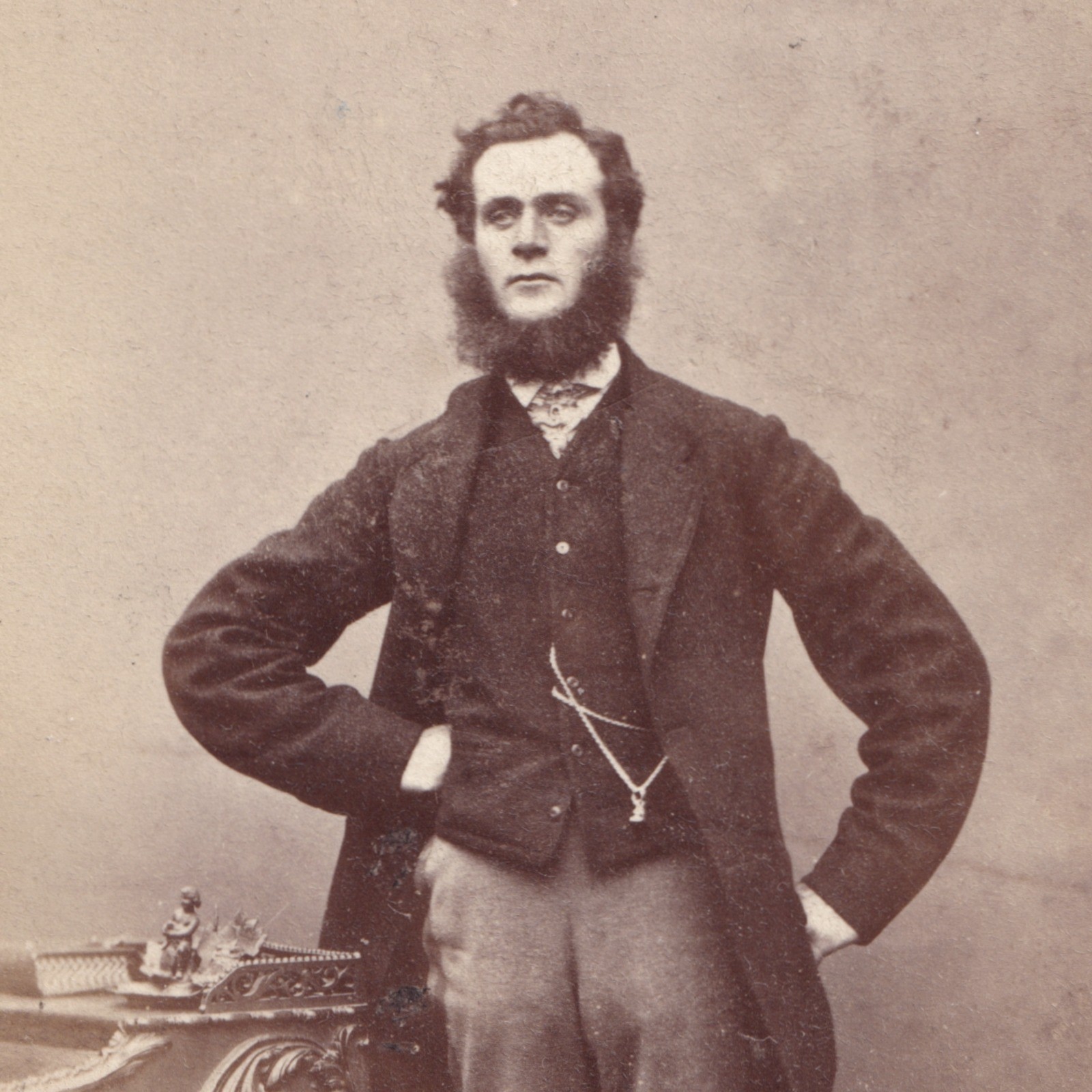CDV: CDV: W. Nichols & Sons Card, Cambridge. Smart Man, Bushy Mutton Chops Beard.: catalogue image 3
