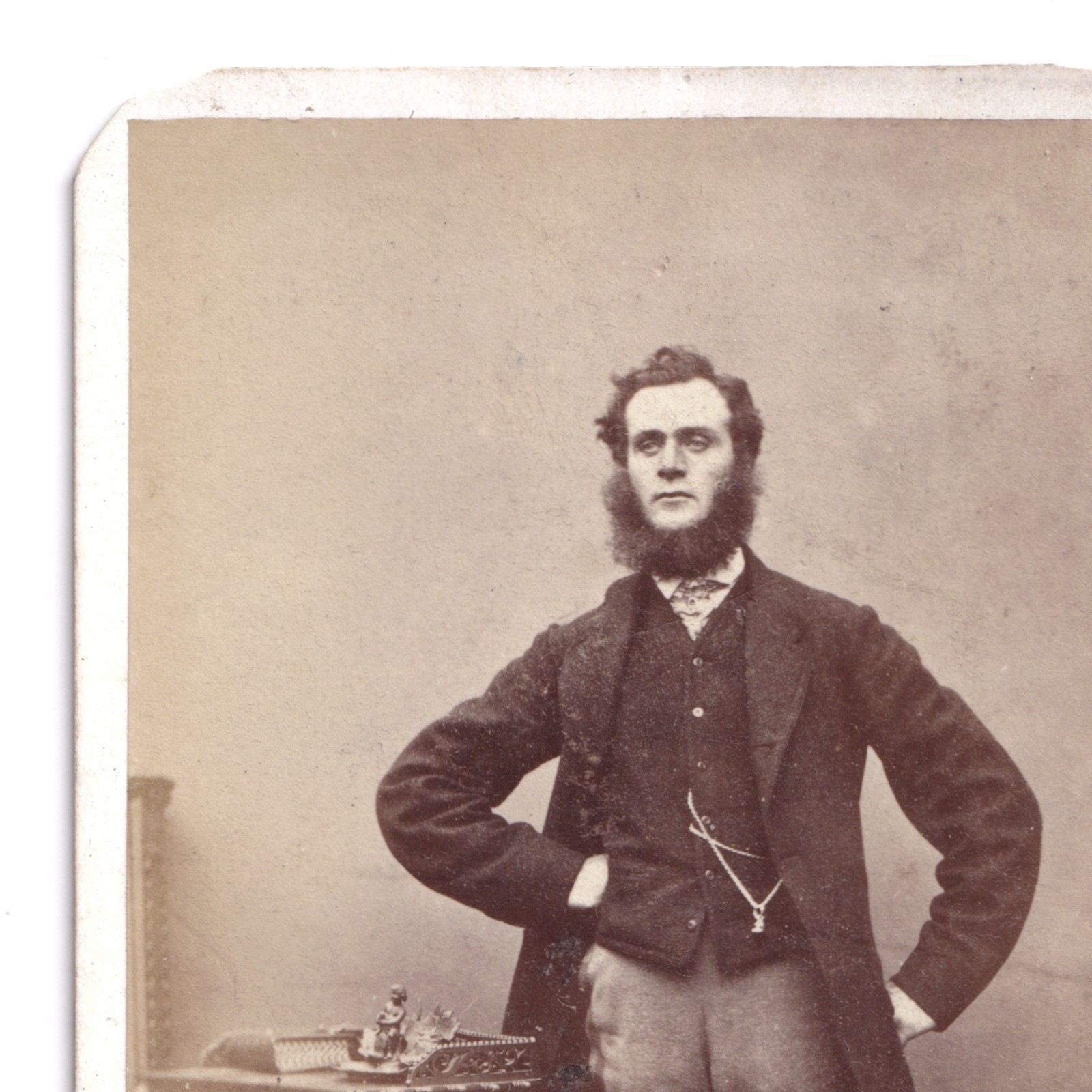CDV: CDV: W. Nichols & Sons Card, Cambridge. Smart Man, Bushy Mutton Chops Beard.: catalogue image 6