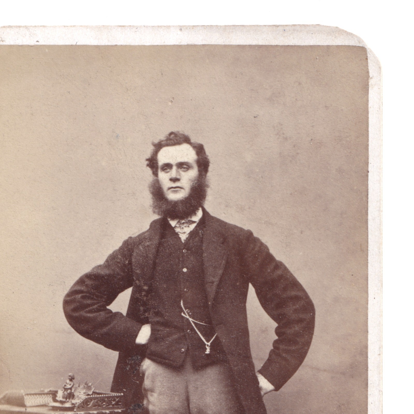 CDV: CDV: W. Nichols & Sons Card, Cambridge. Smart Man, Bushy Mutton Chops Beard.: catalogue image 7